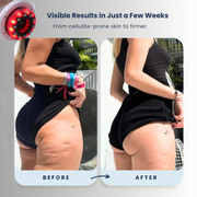 Advanced Skin Massager - 5-in-1 Sculpting & Firming Device with Red Light Therapy