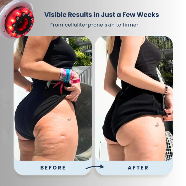 Advanced Skin Massager - 5-in-1 Sculpting & Firming Device with Red Light Therapy